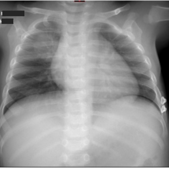 Radiographie enfant